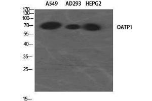 Western Blotting (WB) image for anti-Solute Carrier Organic Anion Transporter Family, Member 1A2 (SLCO1A2) (Internal Region) antibody (ABIN3185985) (SLCO1A2 抗体  (Internal Region))