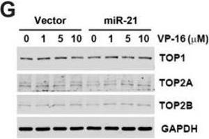 Effect of miR-21 overexpression on chemosensitivity. (Topoisomerase II alpha 抗体  (C-Term))
