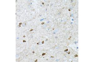 Immunohistochemistry of paraffin-embedded mouse spinal cord using ROCK2 antibody (ABIN5973333) at dilution of 1/100 (40x lens). (ROCK2 抗体)