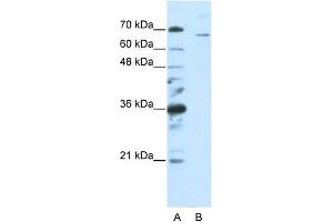 WB Suggested Anti-SF1  Antibody Titration: 0. (Splicing Factor 1 抗体  (C-Term))
