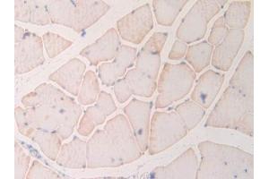 DAB staining on IHC-P; Samples: Rat Skeletal muscle Tissue (MYL6B 抗体  (AA 6-137))