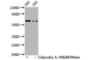 Western Blot Positive WB detected in 293 whole cell lysate(treated with Calyculin A or not) All lanes Phospho-AKT1 antibody at 1. (Recombinant AKT1 抗体  (pSer473))