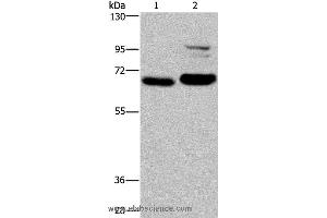 Western blot analysis of K562 and NIH/3T3 cell, using OS9 Polyclonal Antibody at dilution of 1:200 (OS9 抗体)