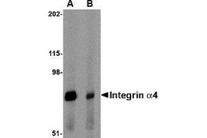 Western blot analysis of Integrin alpha 4 in rat spleen tissue lysate with Integrin alpha 4 antibody at 1 μg/ml in (A) the absence and (B) the presence of blocking peptide. (ITGA4 抗体  (Center))