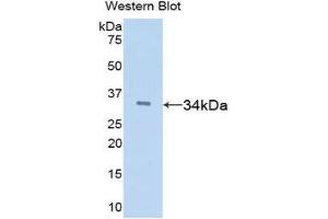 Western Blotting (WB) image for anti-Tissue Factor Pathway Inhibitor (Lipoprotein-Associated Coagulation Inhibitor) (TFPI) (AA 29-302) antibody (ABIN1078584) (TFPI 抗体  (AA 29-302))