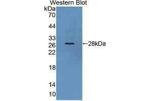 Western blot analysis of the recombinant protein. (CAMLG 抗体  (AA 1-187))
