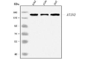 Western blot analysis of SCA2/ATXN2 using anti-SCA2/ATXN2 antibody (ABIN7599900).