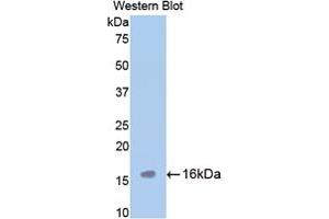Western blot analysis of the recombinant protein. (TPSAB1 抗体  (AA 149-273))
