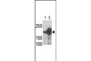 LRP5 Antibody is used in Western blot to detect recombinant human LRP5 (Lane 1) and mouse LRP5 (Lane 2) proteins in transfected 293 cell lysates. (LRP5 抗体  (C-Term))