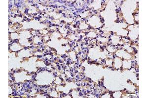 Formalin-fixed and paraffin embedded rat lung tissue labeled with Anti-FBP1 Polyclonal Antibody, Unconjugated  at 1:200 followed by conjugation to the secondary antibody