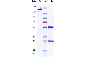 Anti-TIGIT Reference Antibody (vibostolimab) on SDS-PAGE under reducing (R) condition. (Recombinant TIGIT (Vibostolimab Biosimilar) 抗体)