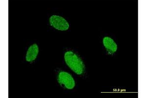 Immunofluorescence of monoclonal antibody to PITX2 on HeLa cell. (PITX2 抗体  (AA 1-324))
