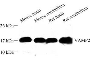 Western blot analysis of VAMP2 (ABIN7076197) at dilution of 1: 500 (VAMP2 抗体)