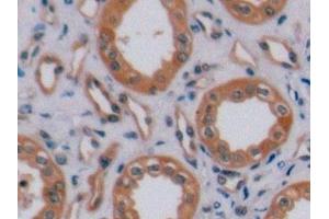 Immunohistochemistry (IHC) image for anti-Receptor tyrosine-protein kinase erbB-2 (ErbB2/Her2) (AA 23-372) antibody (ABIN7444448)
