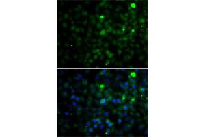 Immunofluorescence analysis of A-549 cells using SMYD4 antibody (ABIN6133038, ABIN6148171, ABIN6148172 and ABIN6223147). (SMYD4 抗体  (AA 1-260))