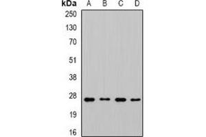 Western blot analysis of CHMP1B expression in MCF7 (A), SKOV3 (B), mouse liver (C), mouse brain (D) whole cell lysates. (CHMP1B 抗体)