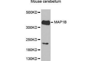Western Blotting (WB) image for anti-Microtubule-Associated Protein 1B (MAP1B) (AA 1820-2100) antibody (ABIN6220205) (MAP1B 抗体  (AA 1820-2100))