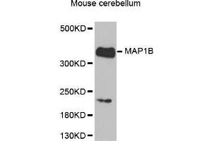 MAP1B 抗体  (AA 1820-2100)