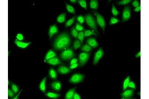Immunofluorescence analysis of MCF7 cells using SPDEF antibody (ABIN6132572, ABIN6148332, ABIN6148334 and ABIN6218364). (SPDEF/PSE 抗体  (AA 1-335))
