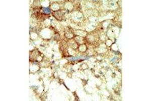 Image no. 2 for anti-Ret Proto-Oncogene (RET) (C-Term) antibody (ABIN359927) (Ret Proto-Oncogene 抗体  (C-Term))