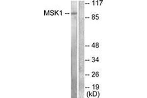 Western blot analysis of extracts from 293 cells, treated with UV 15', using MSK1 (Ab-581) Antibody. (MSK1 抗体  (AA 551-600))