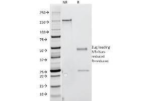 SDS-PAGE Analysis Purified IFNG Mouse Monoclonal Antibody (G-23). (Interferon gamma 抗体)