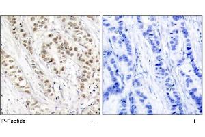 Image no. 1 for anti-Breast Cancer 1 (BRCA1) (pSer1524) antibody (ABIN196816) (BRCA1 抗体  (pSer1524))
