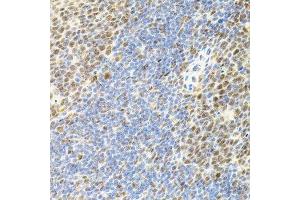 Immunohistochemistry of paraffin-embedded mouse spleen using EIF4G2 antibody. (EIF4G2 抗体  (AA 750-850))