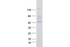 Western Blotting (WB) image for Protein tyrosine Phosphatase, Non-Receptor Type 21 (PTPN21) protein (Myc-DYKDDDDK Tag) (ABIN2730115)