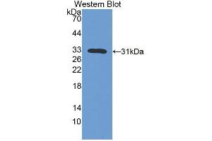 Western blot analysis of the recombinant protein. (IL7R 抗体  (AA 1-239))