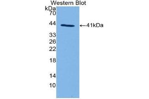 Western Blotting (WB) image for anti-Complement Fragment 3a (C3a) (AA 670-742) antibody (ABIN3208725) (C3a 抗体  (AA 670-742))