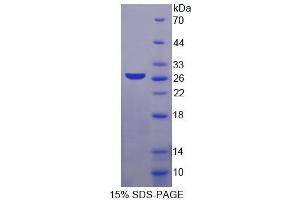 SDS-PAGE analysis of Human MAGEA1 Protein. (MAGEA1 蛋白)