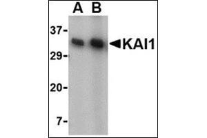 Western blot analysis of KAI1 in A549 cell lysate with this product at (A) 0. (CD82 抗体  (C-Term))