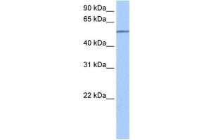 SEMA6D antibody used at 0. (SEMA6D 抗体  (N-Term))