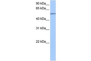Western Blotting (WB) image for anti-Sema Domain, Transmembrane Domain (TM), and Cytoplasmic Domain, (Semaphorin) 6D (SEMA6D) (N-Term) antibody (ABIN635698)