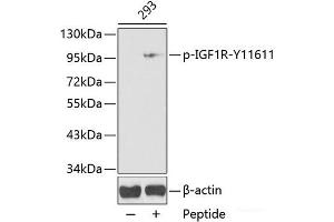 Western blot analysis of extracts from 293 cells using Phospho-IGF1R(Y1161) Polyclonal Antibody. (IGF1R 抗体  (pTyr1161))
