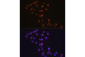 Immunofluorescence (IF) image for anti-DNA (Cytosine-5)-Methyltransferase 1 (DNMT1) antibody (ABIN7266808)
