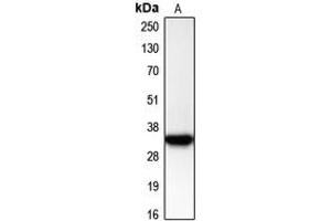 Western blot analysis of CDK2 expression in Jurkat (A) whole cell lysates. (CDK2 抗体  (C-Term))