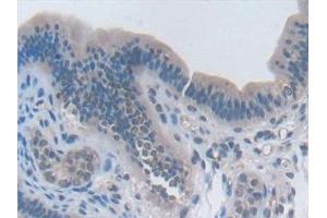 Immunohistochemistry (IHC) image for anti-Interleukin 2 (IL2) (AA 10-169) antibody (ABIN7430798)