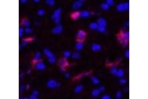 Immunofluorescence analysis of Human appendix tissue using FN1 Monoclonal Antibody at dilution of 1:200. (Fibronectin 1 抗体)