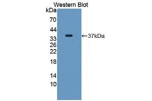 Western blot analysis of the recombinant protein. (GAN 抗体  (AA 30-326))