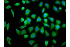 Immunofluorescence staining of A549 cells with ABIN7152106 at 1:100, counter-stained with DAPI.