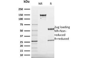 SDS-PAGE Analysis Purified Cytokeratin 20 (KRT20) Mouse Monoclonal Antibody (KRT20/1991).