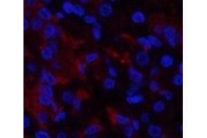 Immunofluorescence analysis of Human stomach tissue using RUNX2 Polyclonal Antibody at dilution of 1:200. (RUNX2 抗体)