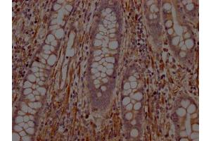 Immunohistochemistry (IHC) image for anti-Protein tyrosine Phosphatase, Non-Receptor Type 1 (PTPN1) antibody (ABIN7127784)