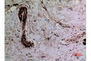 Immunohistochemistry (IHC) analysis of paraffin-embedded Human Breast, antibody was diluted at 1:100.