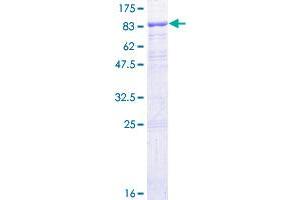 IFNAR1 Protein (AA 1-557) (GST tag)