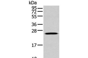 Western blot analysis of A549 cell using FGFBP1 Polyclonal Antibody at dilution of 1:350 (FGFBP1 抗体)