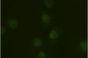 Immunofluorescent staining of HeLa cells using anti-A1AT mouse monoclonal antibody (ABIN2452352). (SERPINA1 抗体  (AA 26-418))