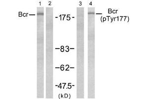 Western blot analysis of extract from A431 ce lls, untreated or treated with EGF (200ng/ml, 5min), using Bcr (Ab-177) antibody (E021197, Lane 1 and 2) and Bcr(phospho-Tyr177) antibody (E011199, Lane 3 and 4). (BCR 抗体  (pTyr177))
